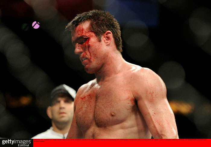 Chael Sonnen