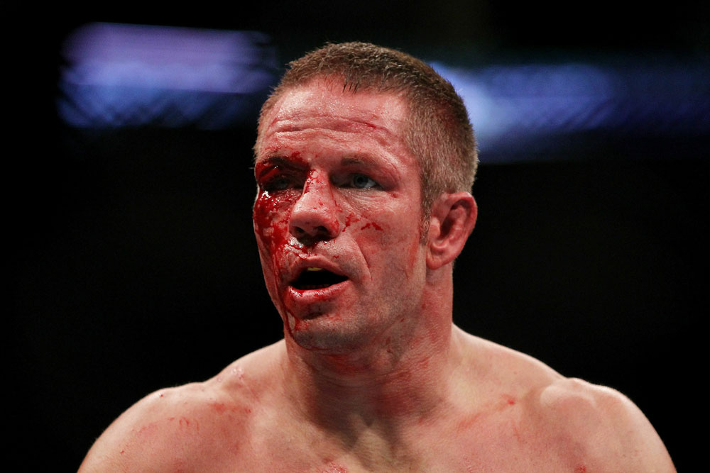 UFC 118 Diaz vs. Davis