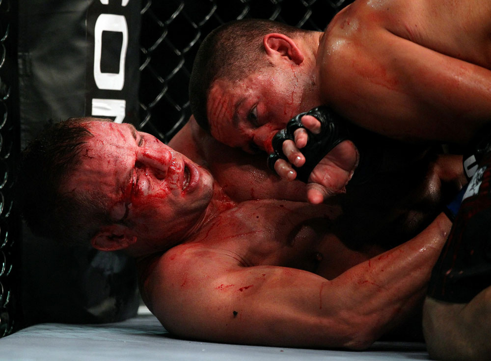 UFC 118 Diaz vs. Davis