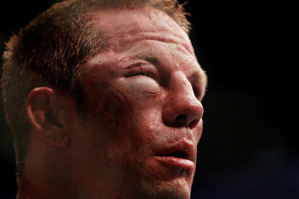 UFC 118 Diaz vs. Davis