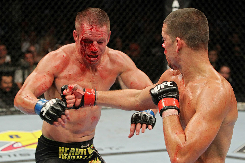 UFC 118 Diaz vs. Davis