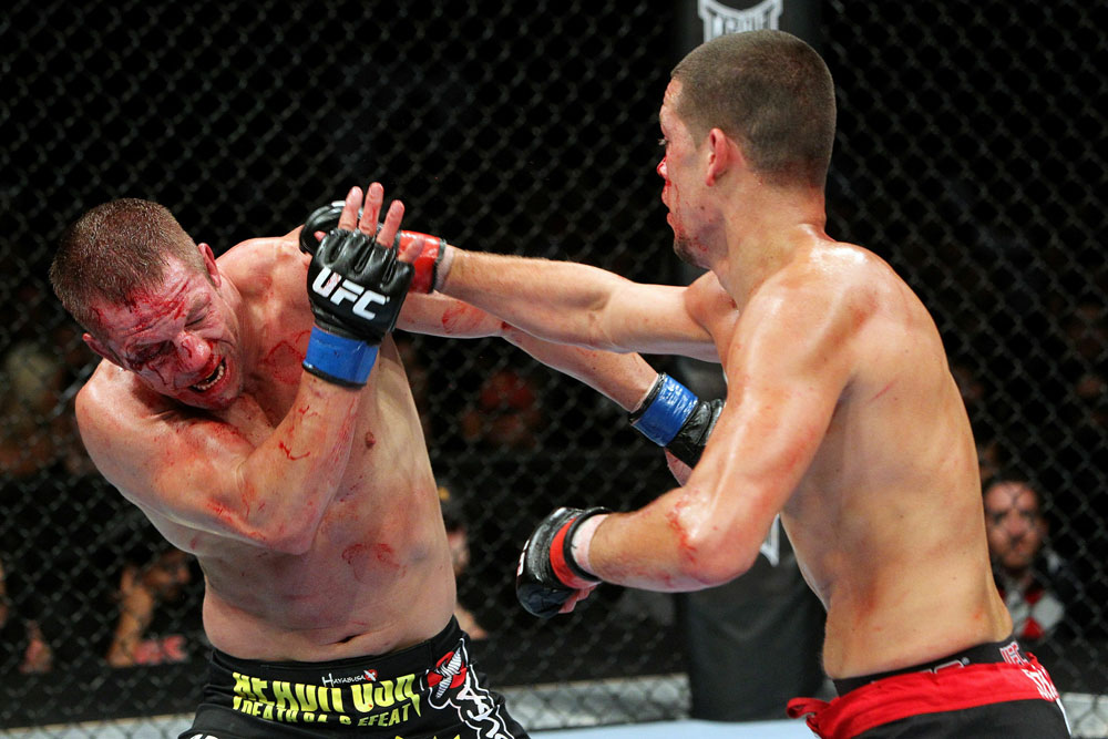 UFC 118 Diaz vs. Davis