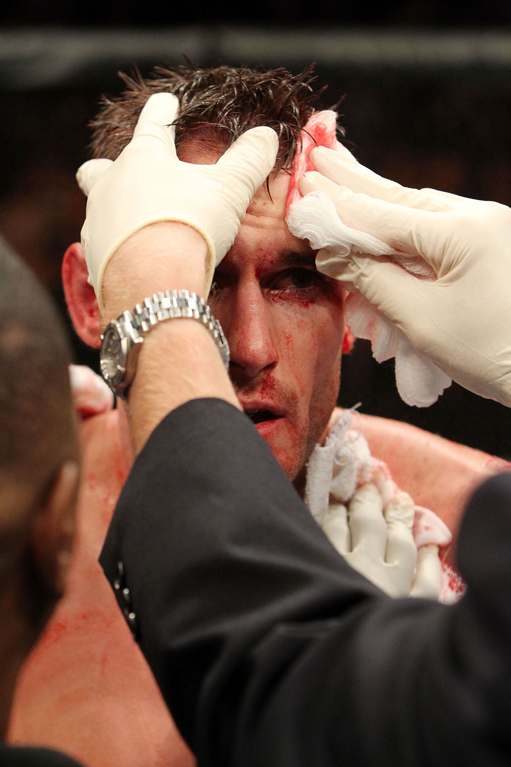 UFC 119: Lopez vs. Lowe