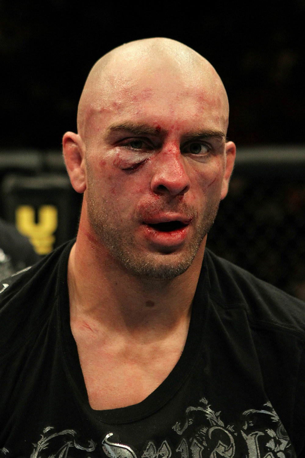 UFC 124: Sean Pierson after his fight against Matt Riddle.