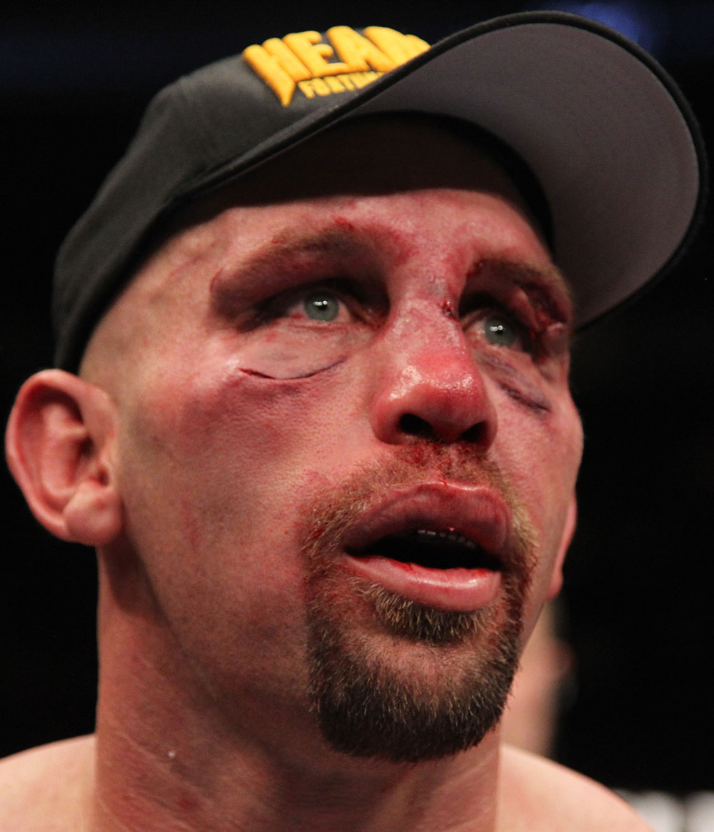 Shane Carwin