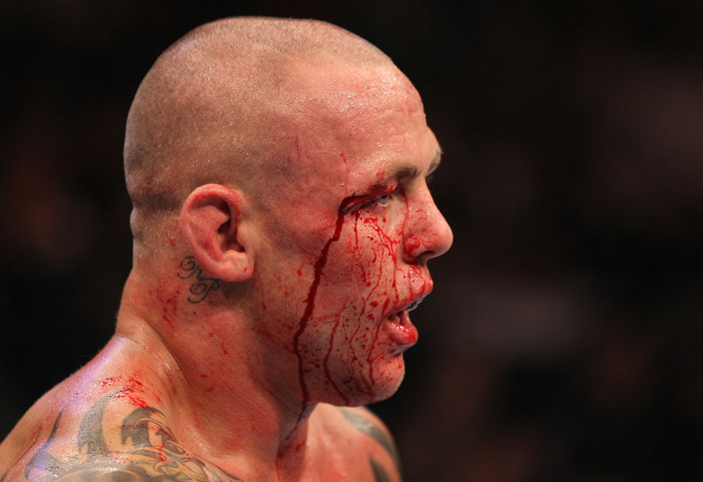 Ross Pearson