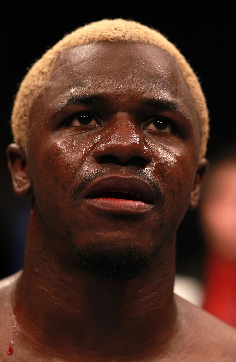 Melvin Guillard after his loss to Joe Lauzon