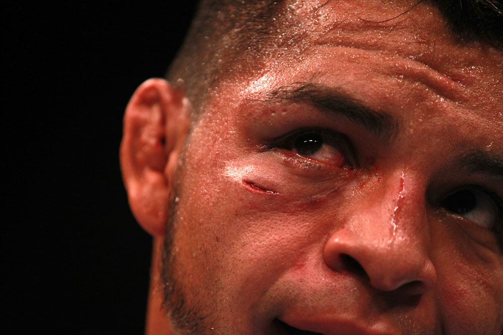 Leonard Garcia after the fight