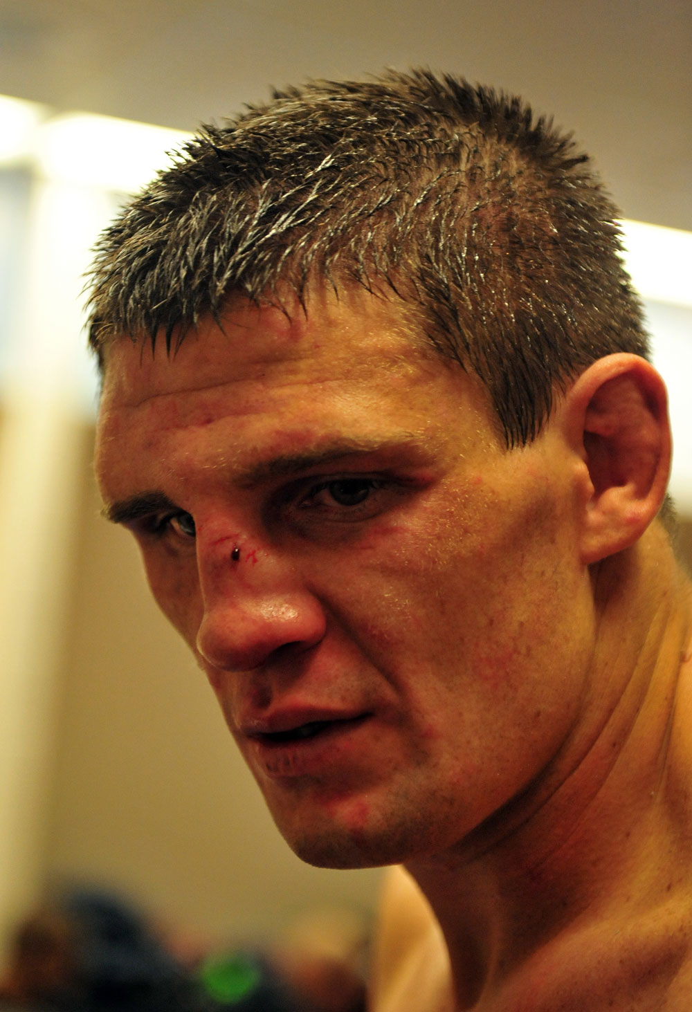 Steve Cantwell after his loss to Mike Massenzio