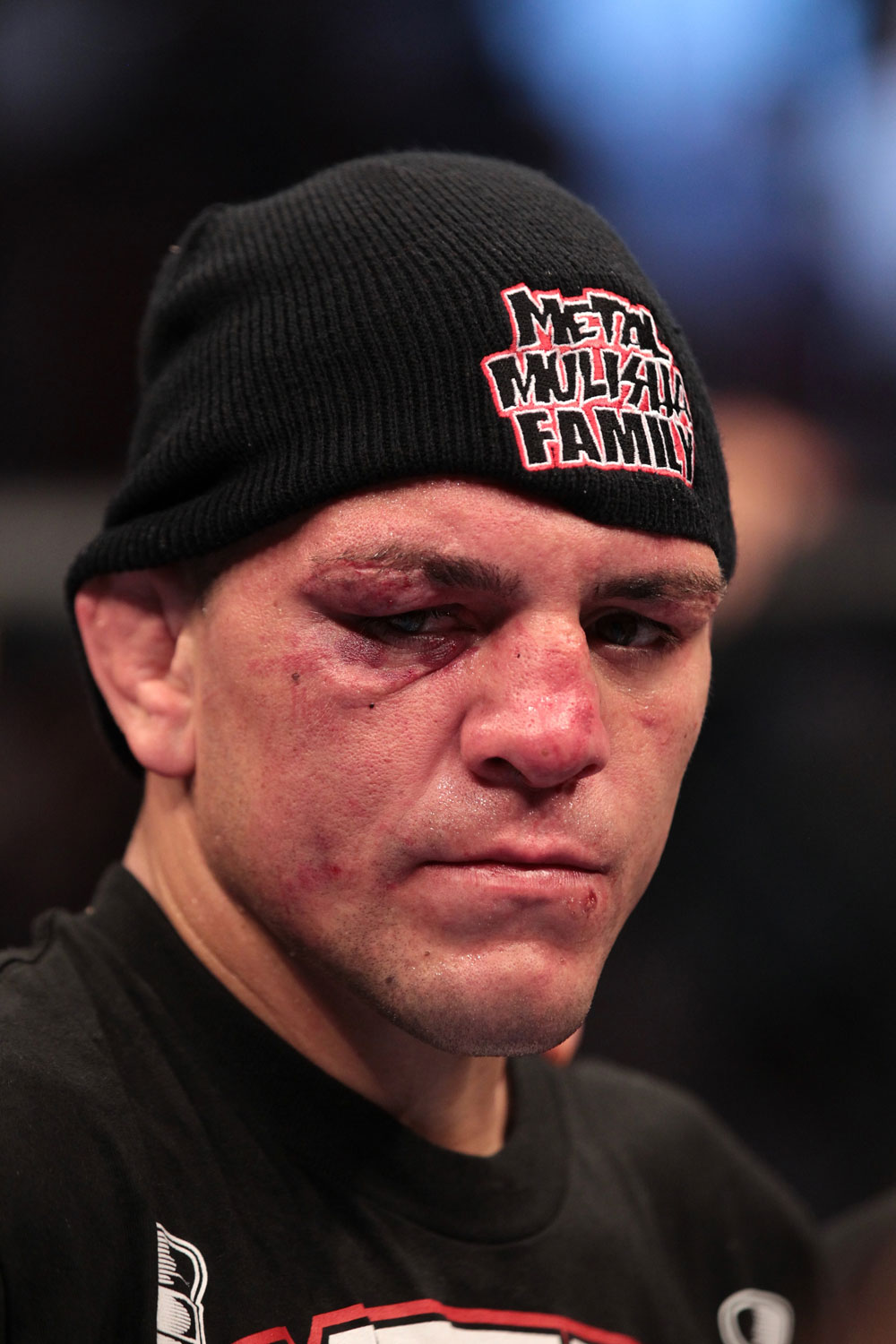 Nick Diaz after the fight