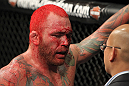 Chris Leben after the fight