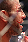 TORONTO, ON - DECEMBER 10:  John Makdessi reacts after suffering a defeat to Dennis Hallman during the UFC 140 event at Air Canada Centre on December 10, 2011 in Toronto, Ontario, Canada.  (Photo by Nick Laham/Zuffa LLC/Zuffa LLC via Getty Images)