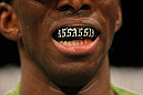 LAS VEGAS, NV - DECEMBER 30:  Anthony Njokuani shows his mouthpiece during the UFC 141 event at the MGM Grand Garden Arena on December 30, 2011 in Las Vegas, Nevada.  (Photo by Donald Miralle/Zuffa LLC/Zuffa LLC via Getty Images) *** Local Caption *** Anthony Njokuani