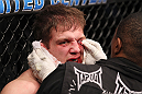 CHICAGO, IL - JANUARY 28:  Nik Lentz is treated for a cut during his bout against Evan Dunham during the UFC on FOX event at United Center on January 28, 2012 in Chicago, Illinois.  (Photo by Nick Laham/Zuffa LLC/Zuffa LLC via Getty Images) *** Local Caption *** Nik Lentz