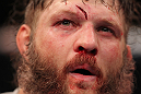 LAS VEGAS, NV - FEBRUARY 04:  Roy Nelson displays his cut from his fight with Fabricio Werdum during the UFC 143 event at Mandalay Bay Events Center on February 4, 2012 in Las Vegas, Nevada.  (Photo by Nick Laham/Zuffa LLC/Zuffa LLC via Getty Images) *** Local Caption *** Roy Nelson