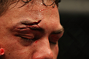 LAS VEGAS, NV - MAY 26:  A closeup of Shane Del Rosario's face during a heavyweight bout at UFC 146 at MGM Grand Garden Arena on May 26, 2012 in Las Vegas, Nevada.  (Photo by Donald Miralle/Zuffa LLC/Zuffa LLC via Getty Images)