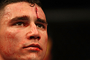 ATLANTIC CITY, NJ - JUNE 22:  Joe Gambino looks on after losing by submission guillotine choke to Steven Siler (not pictured) in a featherweight bout during UFC on FX 4 at Revel Casino on June 22, 2012 in Atlantic City, New Jersey.  (Photo by Nick Laham/Zuffa LLC/Zuffa LLC)