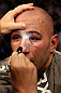 LOS ANGELES, CA - AUGUST 04:  Brandon Vera is checked out by medical staff after being defeated by Shogun Rua in the fourth round during the UFC on FOX at Staples Center on August 4, 2012 in Los Angeles, California.  (Photo by Josh Hedges/Zuffa LLC/Zuffa LLC via Getty Images)