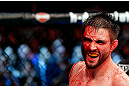 MONTREAL, QC - NOVEMBER 17:  A cut and bloodied Carlos Condit reacts after a round against Georges St-Pierre in their welterweight title bout during UFC 154 on November 17, 2012  at the Bell Centre in Montreal, Canada.  (Photo by Josh Hedges/Zuffa LLC/Zuffa LLC via Getty Images)