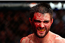 MONTREAL, QC - NOVEMBER 17:  A cut and bloodied Carlos Condit reacts after a round against Georges St-Pierre in their welterweight title bout during UFC 154 on November 17, 2012  at the Bell Centre in Montreal, Canada.  (Photo by Josh Hedges/Zuffa LLC/Zuffa LLC via Getty Images)