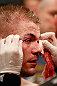 LONDON, ENGLAND - FEBRUARY 16:  Michael McDonald is treated by a cut man after his loss to Renan Barao in their interim bantamweight title fight during the UFC on Fuel TV event on February 16, 2013 at Wembley Arena in London, England.  (Photo by Josh Hedges/Zuffa LLC/Zuffa LLC via Getty Images)