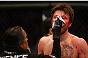 MONTREAL, QC - MARCH 16: Dan Miller gets looked at by the cut man after being defeated by Jordan Mein in their welterweight bout during the UFC 158 event at Bell Centre on March 16, 2013 in Montreal, Quebec, Canada.  (Photo by Jonathan Ferrey/Zuffa LLC/Zuffa LLC via Getty Images)