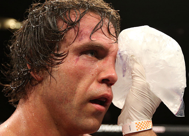NOTTINGHAM, ENGLAND - SEPTEMBER 29: Kyle Kingsbury applies ice to his eye after his TKO loss against Jimi Manuwa at the UFC on Fuel TV event at Capital FM Arena on September 29, 2012 in Nottingham, England. (Photo by Josh Hedges/Zuffa LLC/Zuffa LLC via Getty Images)