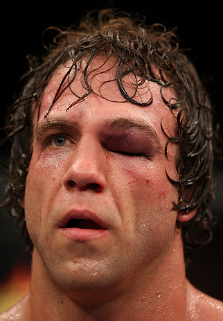 NOTTINGHAM, ENGLAND - SEPTEMBER 29: Kyle Kingsbury stands in the Octagon after his TKO loss against Jimi Manuwa at the UFC on Fuel TV event at Capital FM Arena on September 29, 2012 in Nottingham, England. (Photo by Josh Hedges/Zuffa LLC/Zuffa LLC via Getty Images)