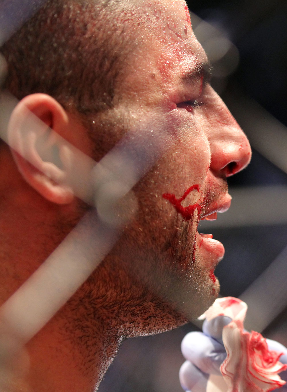 TORONTO, ON - DECEMBER 10:  John Makdessi reacts after suffering a defeat to Dennis Hallman during the UFC 140 event at Air Canada Centre on December 10, 2011 in Toronto, Ontario, Canada.  (Photo by Nick Laham/Zuffa LLC/Zuffa LLC via Getty Images)