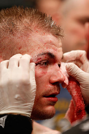 LONDON, ENGLAND - FEBRUARY 16: Michael McDonald is treated by a cut man after his loss to Renan Barao in their interim bantamweight title fight during the UFC on Fuel TV event on February 16, 2013 at Wembley Arena in London, England. (Photo by Josh Hedges/Zuffa LLC/Zuffa LLC via Getty Images)