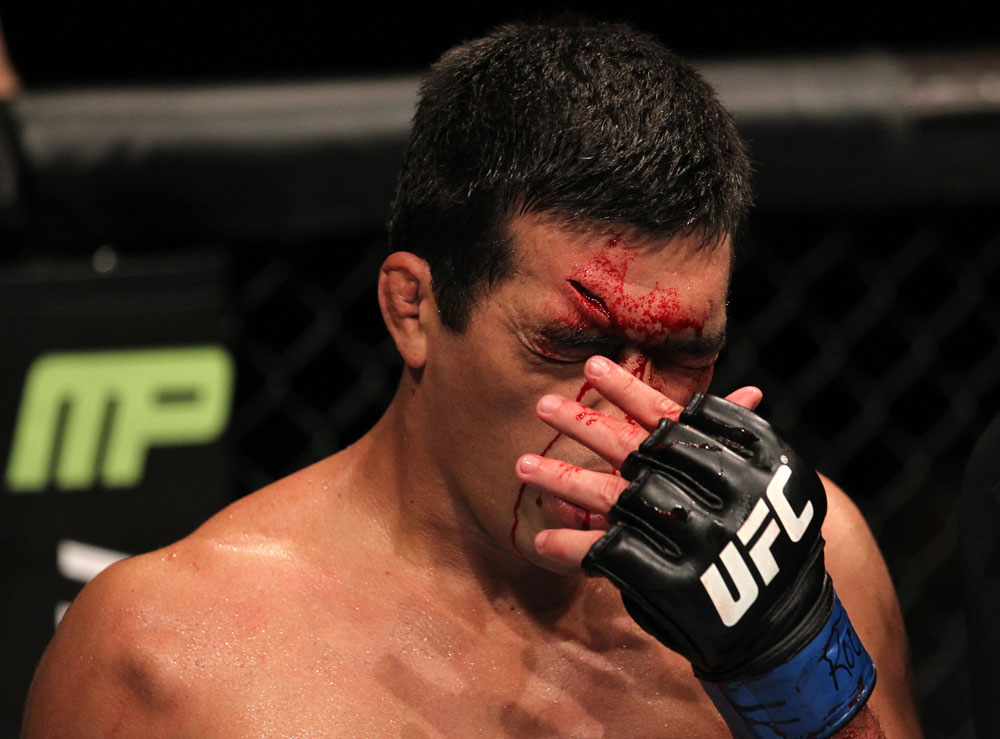 TORONTO, ON - DECEMBER 10:  Lyoto Machida wipes blood from his face during his bout agaisnt Jon Jones during the UFC 140 event at Air Canada Centre on December 10, 2011 in Toronto, Ontario, Canada.  (Photo by Nick Laham/Zuffa LLC/Zuffa LLC via Getty Images)