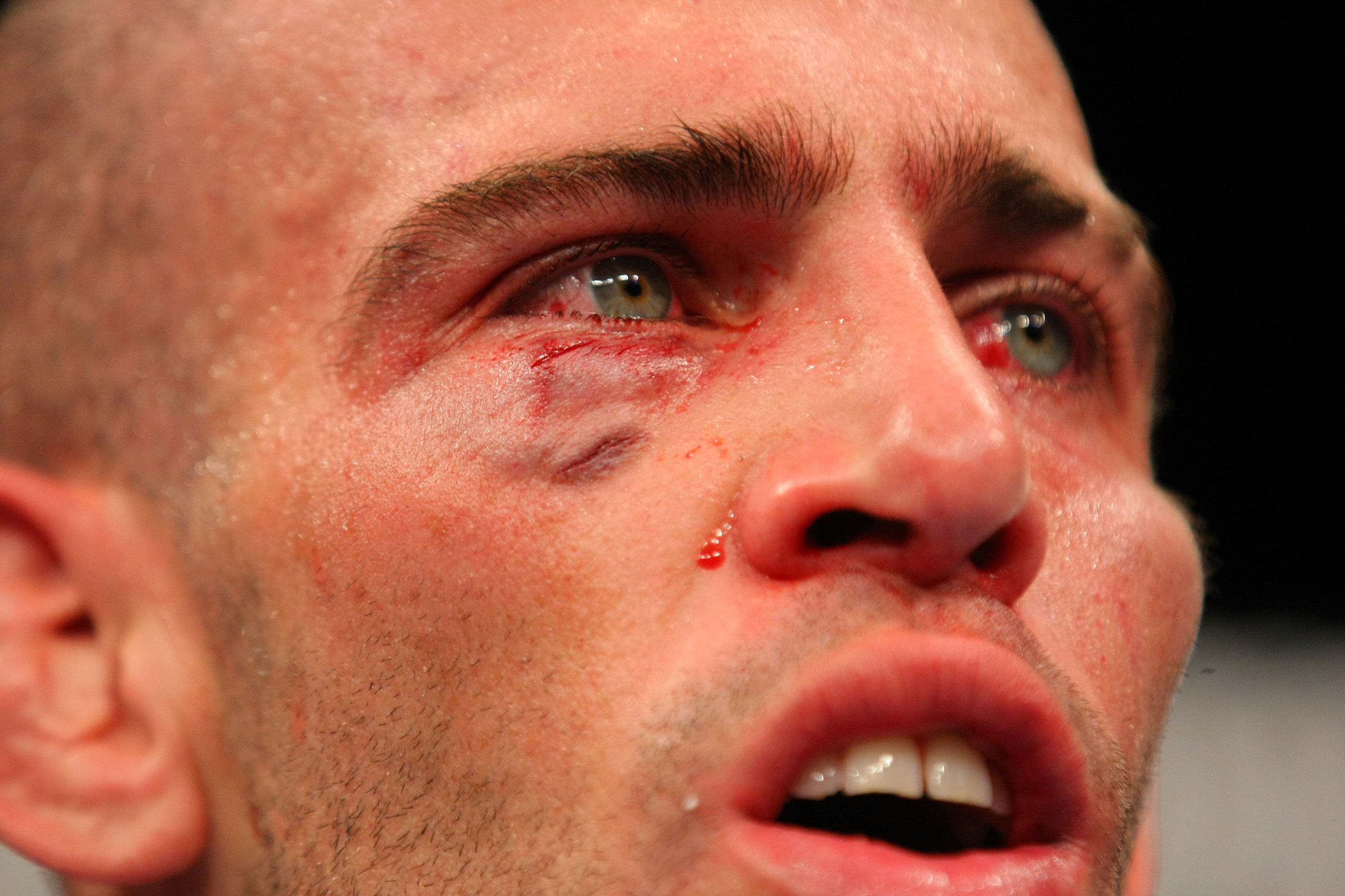 LAS VEGAS, NV - DECEMBER 30: Junior Assuncao after his fight with Ross Pearson during the UFC 141 event at the MGM Grand Garden Arena on December 30, 2011 in Las Vegas, Nevada. (Photo by Donald Miralle/Zuffa LLC/Zuffa LLC via Getty Images) *** Local Caption *** Junior Assuncao