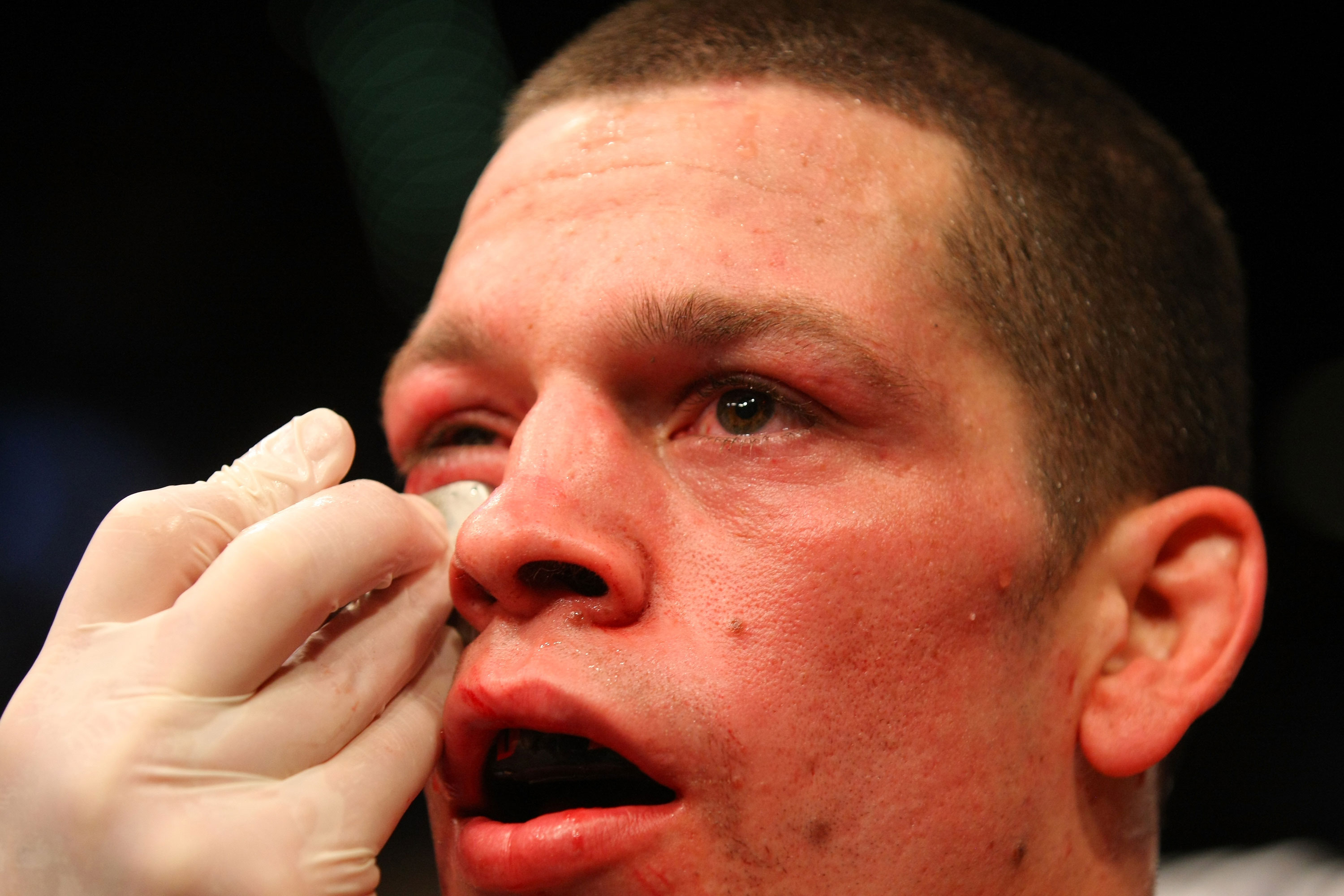 LAS VEGAS, NV - DECEMBER 30: Nate Diaz is inspected by cutmen after his fight with Donald Cerrone during the UFC 141 event at the MGM Grand Garden Arena on December 30, 2011 in Las Vegas, Nevada. (Photo by Donald Miralle/Zuffa LLC/Zuffa LLC via Getty Images) *** Local Caption *** Nate Diaz; Donald Cerrone
