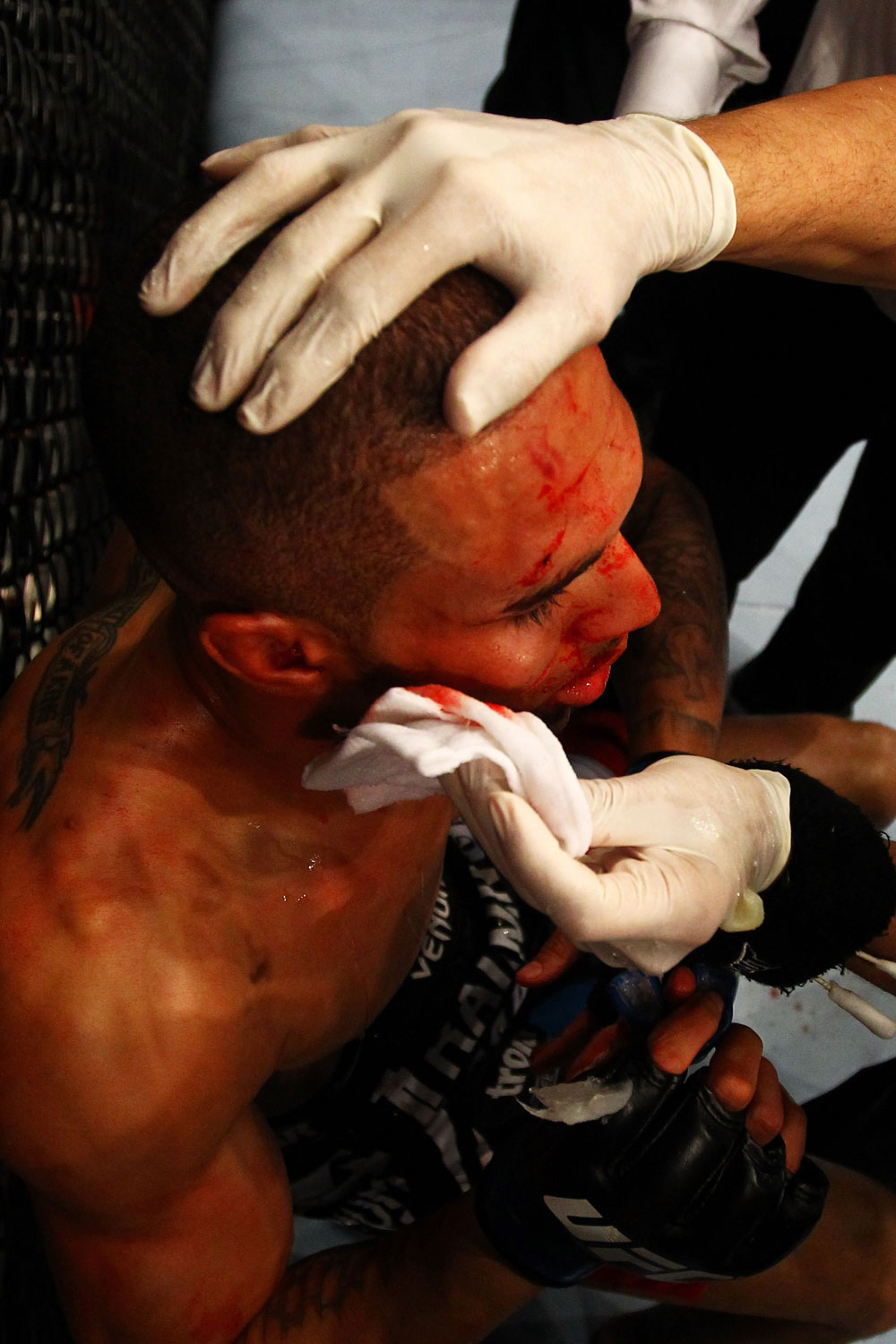ATLANTA, GA - APRIL 21:  Che Mills recieves medical attention during his welterweight bout against Rory MacDonald for UFC 145 at Philips Arena on April 21, 2012 in Atlanta, Georgia.  (Photo by Al Bello/Zuffa LLC/Zuffa LLC via Getty Images)