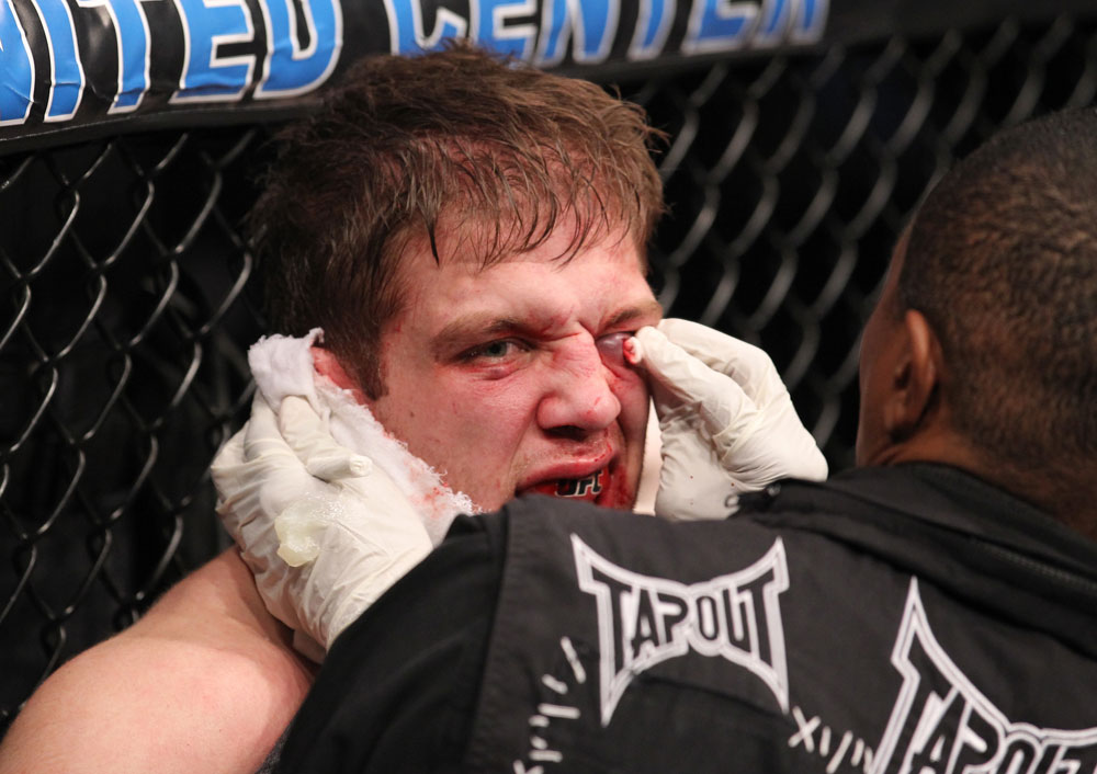 CHICAGO, IL - JANUARY 28:  Nik Lentz is treated for a cut during his bout against Evan Dunham during the UFC on FOX event at United Center on January 28, 2012 in Chicago, Illinois.  (Photo by Nick Laham/Zuffa LLC/Zuffa LLC via Getty Images) *** Local Caption *** Nik Lentz