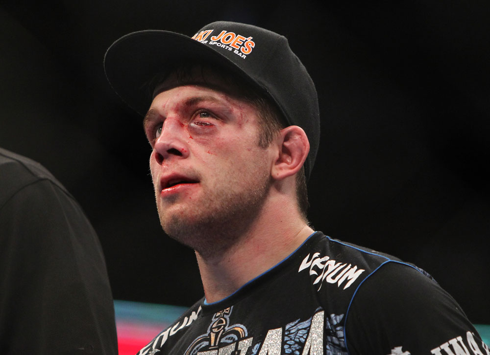 CHICAGO, IL - JANUARY 28:  Nik Lentz reacts after his loss to Evan Dunham during the UFC on FOX event at United Center on January 28, 2012 in Chicago, Illinois.  (Photo by Josh Hedges/Zuffa LLC/Zuffa LLC via Getty Images) *** Local Caption *** Nik Lentz