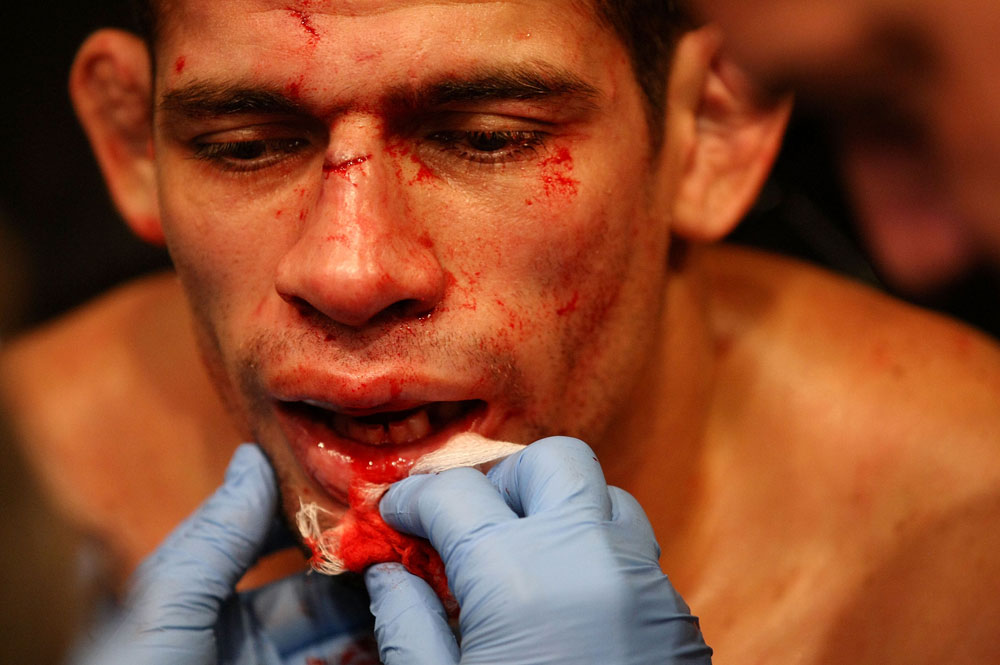 ATLANTIC CITY, NJ - JUNE 22:  Luis Ramos is tended to during his welterweight bout against Matt Brown (not pictured) during UFC on FX 4 at Revel Casino on June 22, 2012 in Atlantic City, New Jersey.  (Photo by Nick Laham/Zuffa LLC/Zuffa LLC)