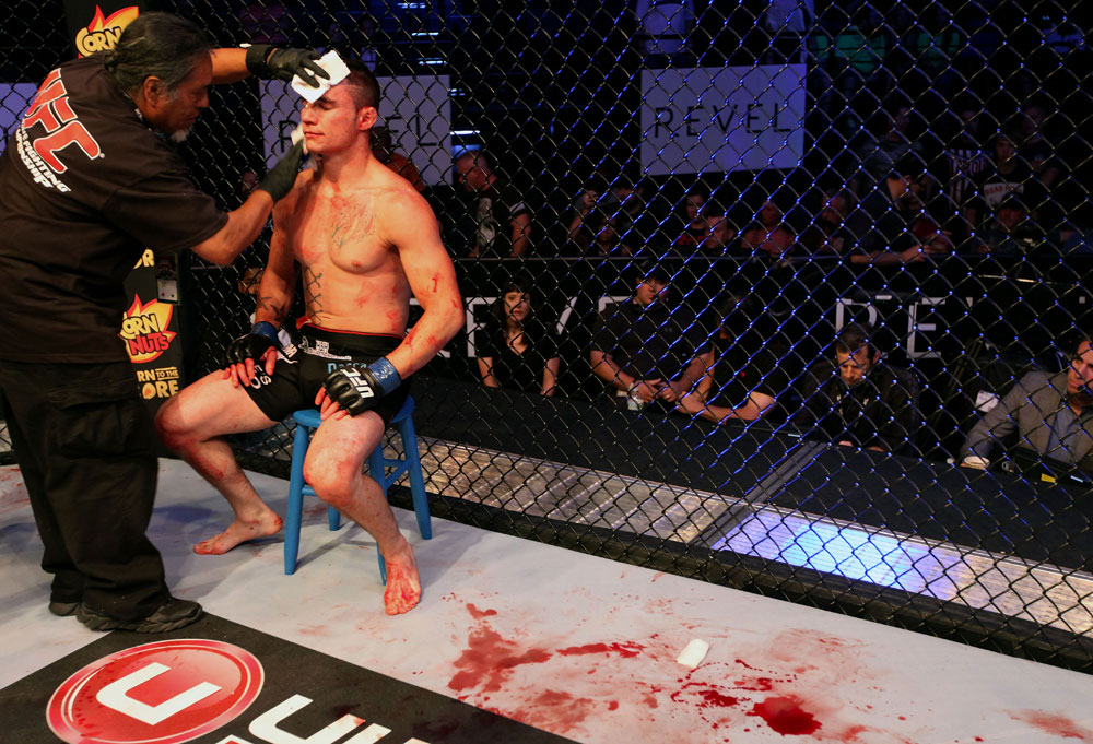 ATLANTIC CITY, NJ - JUNE 22: Joe Gambino is tended to between rounds in a featherweight bout against Steven Siler (not pictured) during UFC on FX 4 at Revel Casino on June 22, 2012 in Atlantic City, New Jersey.  (Photo by Nick Laham/Zuffa LLC/Zuffa LLC)