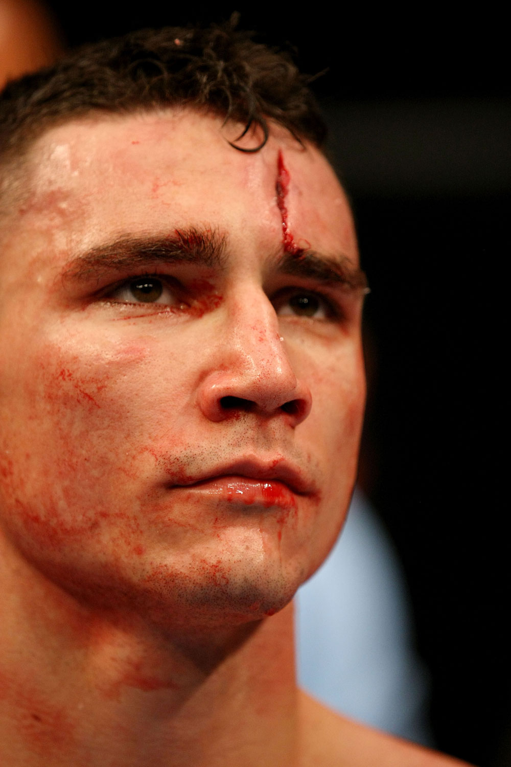 ATLANTIC CITY, NJ - JUNE 22:  Joe Gambino looks on after losing by submission guillotine choke to Steven Siler (not pictured) in a featherweight bout during UFC on FX 4 at Revel Casino on June 22, 2012 in Atlantic City, New Jersey.  (Photo by Nick Laham/Zuffa LLC/Zuffa LLC)