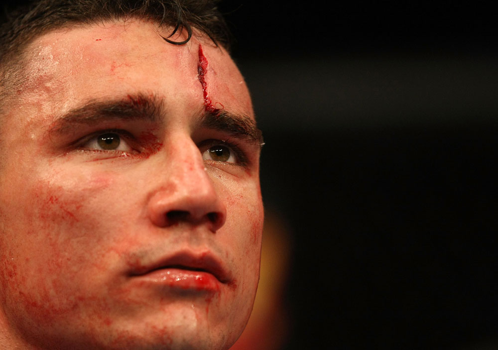 ATLANTIC CITY, NJ - JUNE 22:  Joe Gambino looks on after losing by submission guillotine choke to Steven Siler (not pictured) in a featherweight bout during UFC on FX 4 at Revel Casino on June 22, 2012 in Atlantic City, New Jersey.  (Photo by Nick Laham/Zuffa LLC/Zuffa LLC)