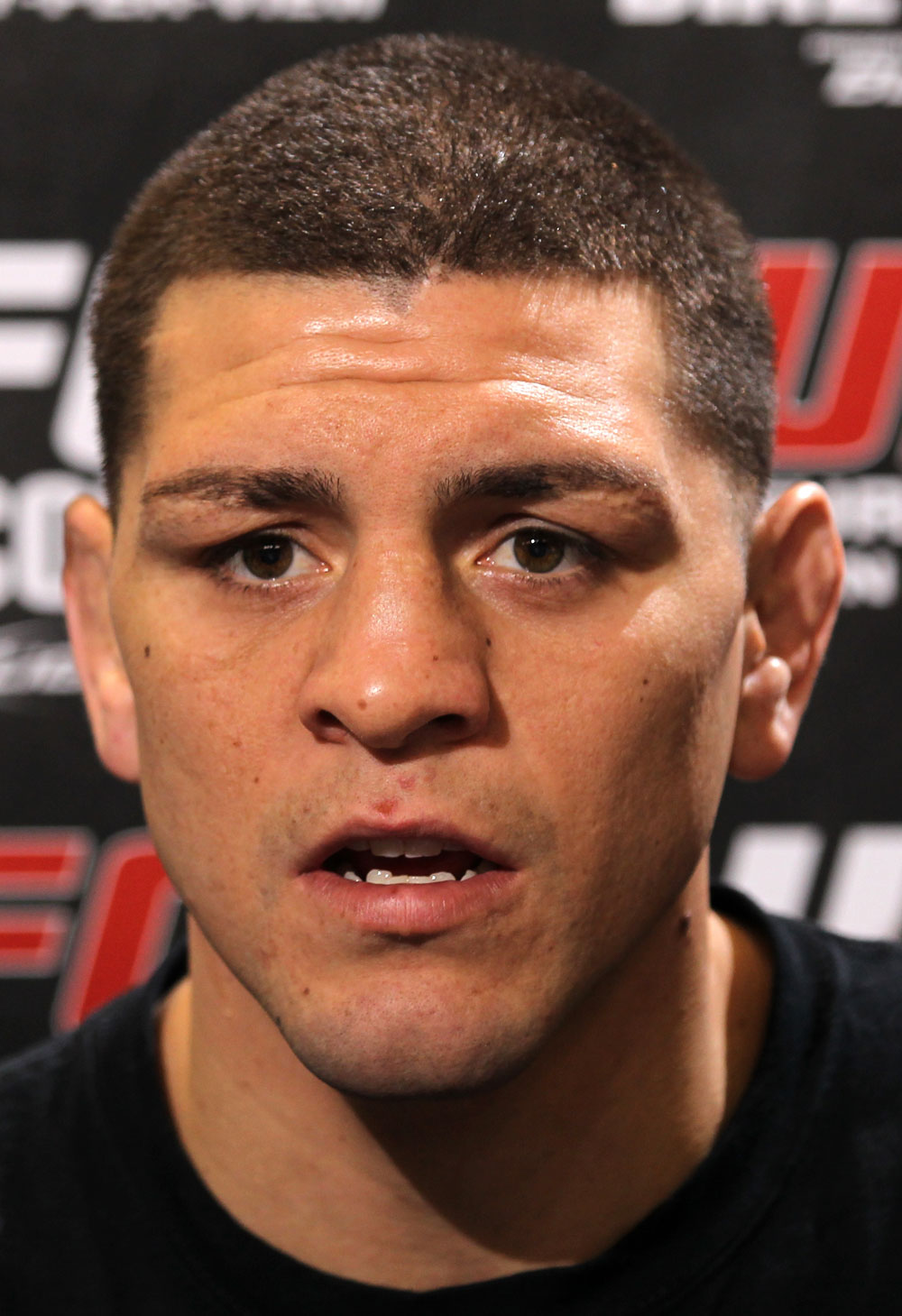 LAS VEGAS, NV - FEBRUARY 01: Nick Diaz answers questions from the media during the UFC 143 open workouts at Mandalay Bay Events Center on February 1, 2012 in Las Vegas, United States. (Photo by Josh Hedges/Zuffa LLC/Zuffa LLC via Getty Images) *** Local Caption *** Nick Diaz