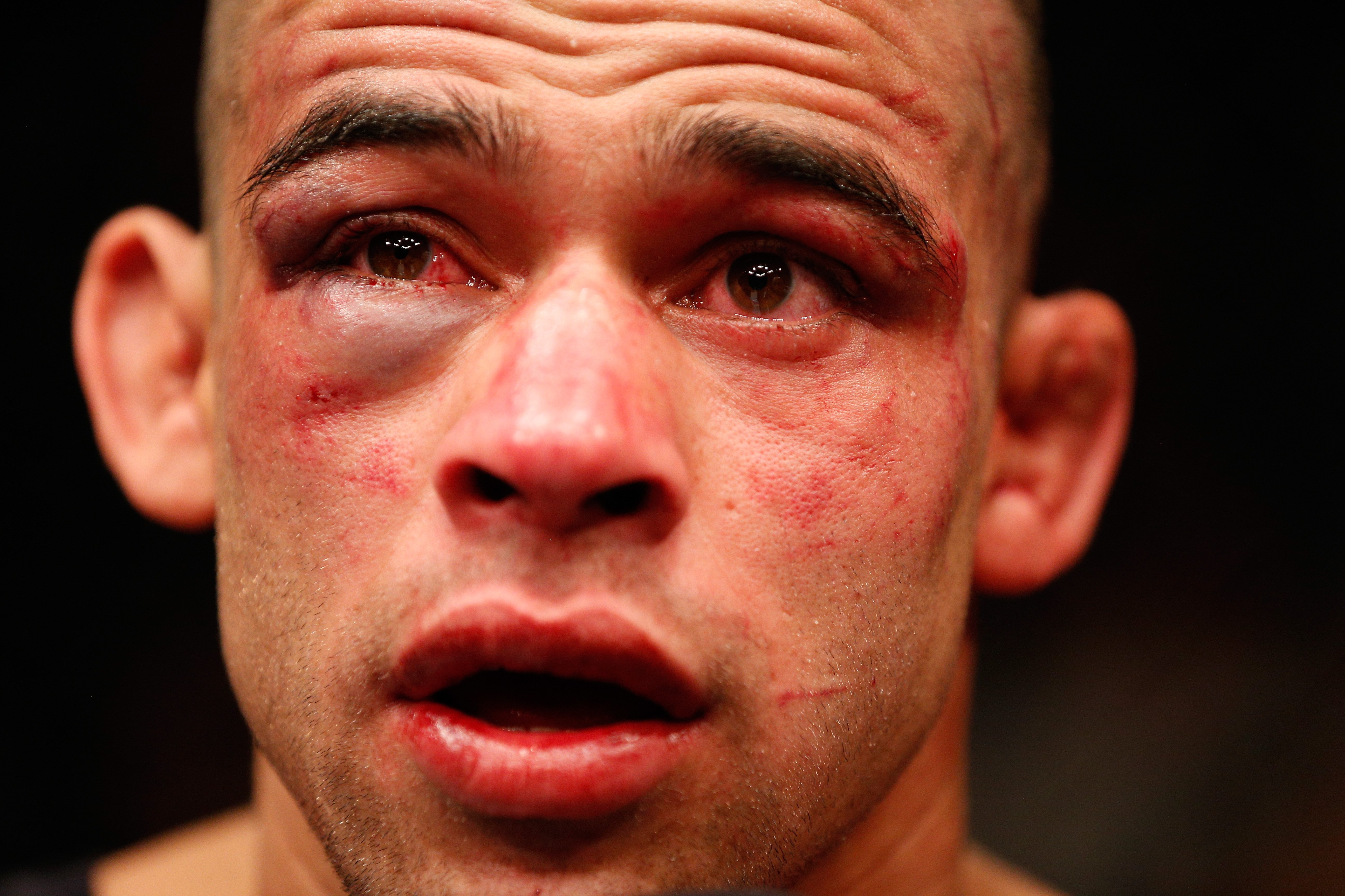 Renan Barao Renan Barao